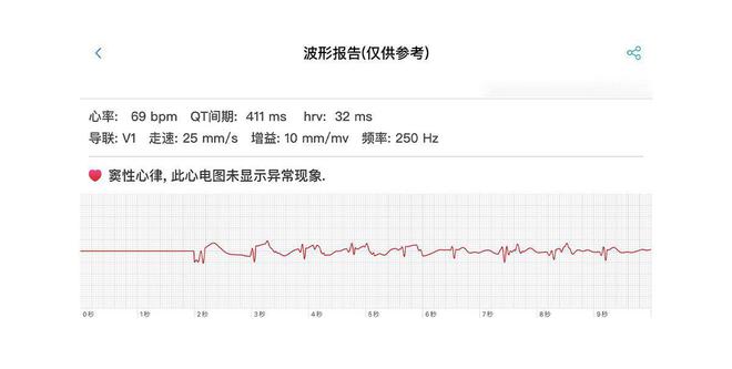 智能手環(huán)能測(cè)血壓心電？dido Y1高精度測(cè)血壓手環(huán)孝敬父母沒商量(圖7)