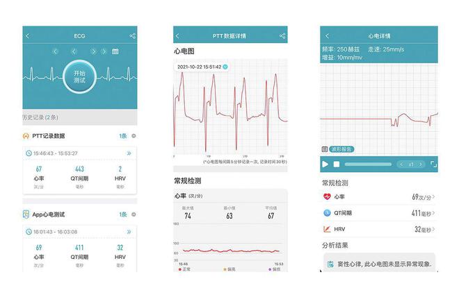 智能手環(huán)能測(cè)血壓心電？dido Y1高精度測(cè)血壓手環(huán)孝敬父母沒商量(圖9)